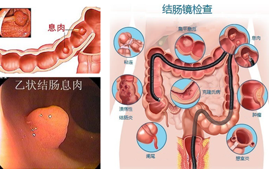 便秘看什么科